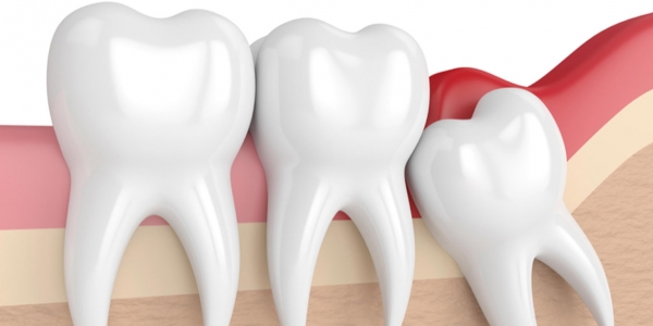 Chirurgia stomatologiczna